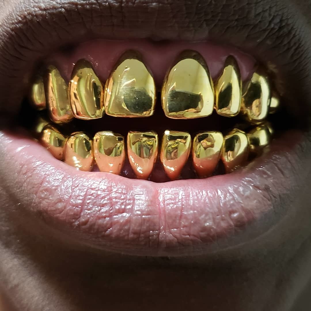 22kt Permanent teeth /crowns